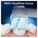 Сменные насадки для зубной щетки Oral-B iO Gentle Care (4 шт.) в Уфе